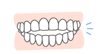 前歯が噛み合わない